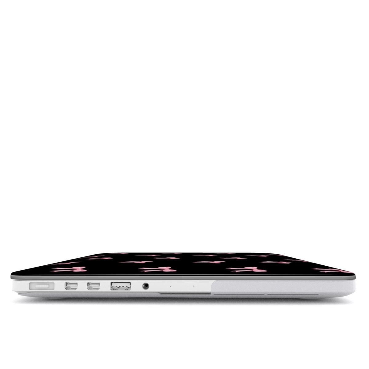 Crooked ribbons black MacBook Case