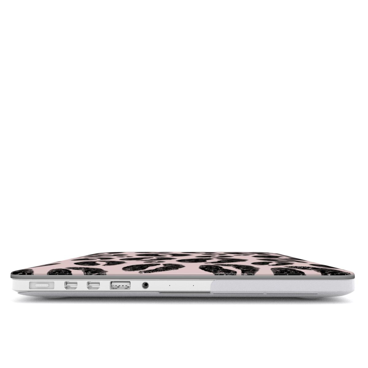 Kisses pink MacBook Case