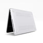 Lucky girl syndrome burgundy MacBook Case