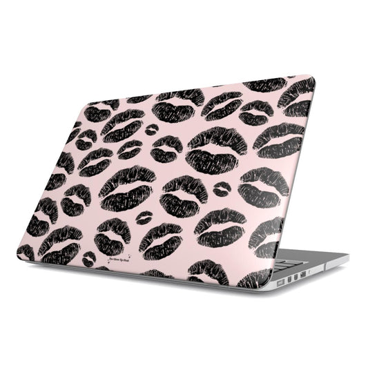 Kisses pink MacBook Case